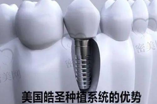 上海瑞伢美口腔瑞都口腔价格表：