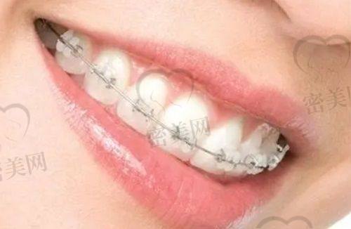 上海黄海明口腔诊所特色优势：