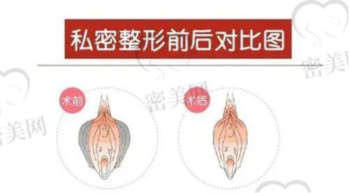 黄名斗医生技术特点：