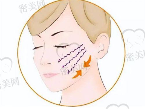 韦婷医生口碑怎么样？