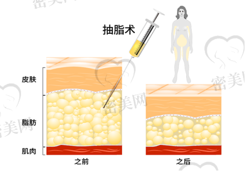 风险与注意事项