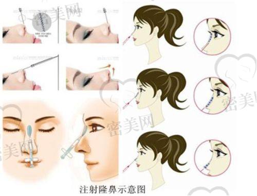 韦婷医生荣誉资质：