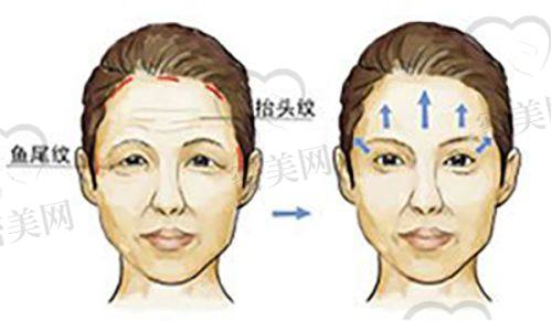 填充成效、维持时间大揭秘