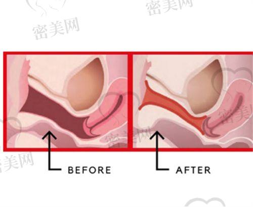 张越越医生荣誉资质：