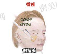 陈成医生荣誉资质：