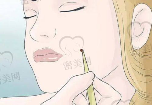 填充风险与注意事项