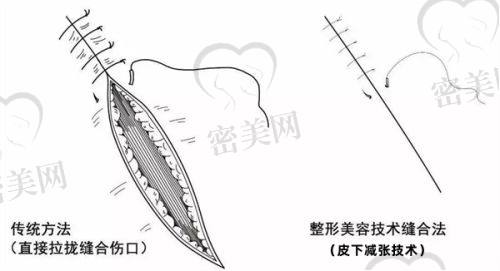 许佑勇医生技术特点：