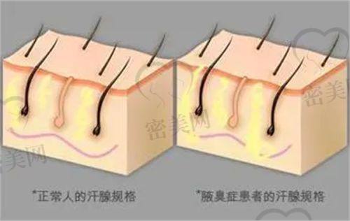郝文玉医生怎么预约挂号？