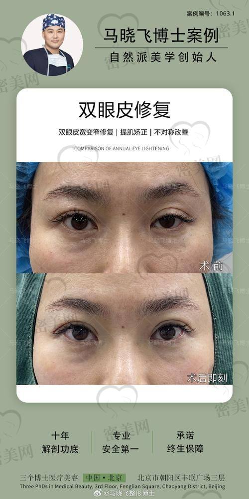 真实见证！那些被张颖救回来的“修不活眼睛”到底有多神？