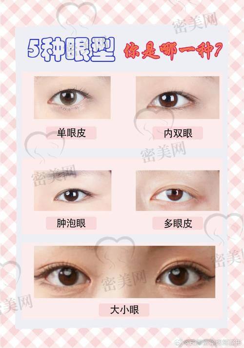 北京丰联丽格：S - ACC青芒双眼皮的梦幻摇篮！