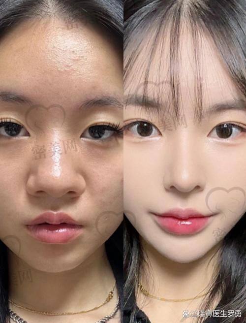 北京美莱王旭东医生是谁？医生背景&专精实力解读