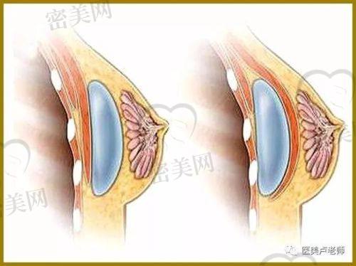 北京米兰柏羽丽都整形医院胡彬：实力医生的魅力所在