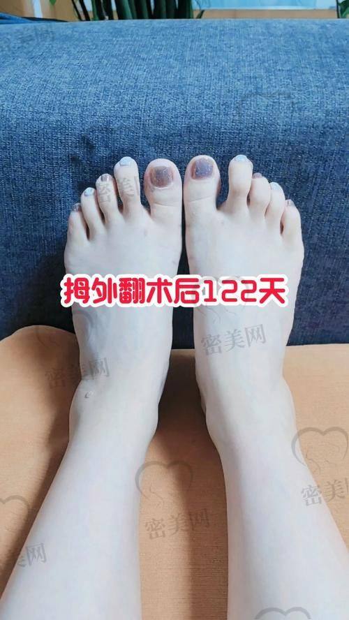 沈阳华正足病诊所：保守调理体验优选地