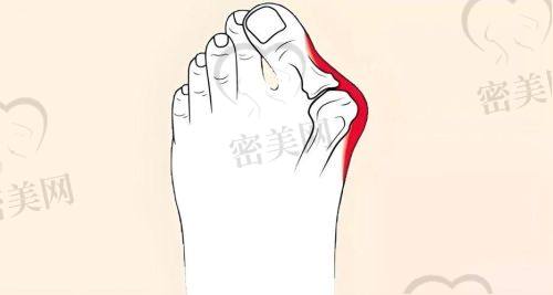 沈阳杰伦骨专医院：科技+手工并驾齐驱