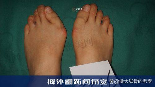 沈阳北方足踝整形医院：定位精细矫正中的“老炮”