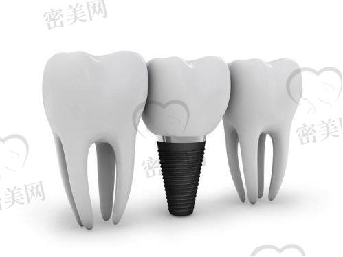 阳光树口腔医院牙齿矫正价目表参考