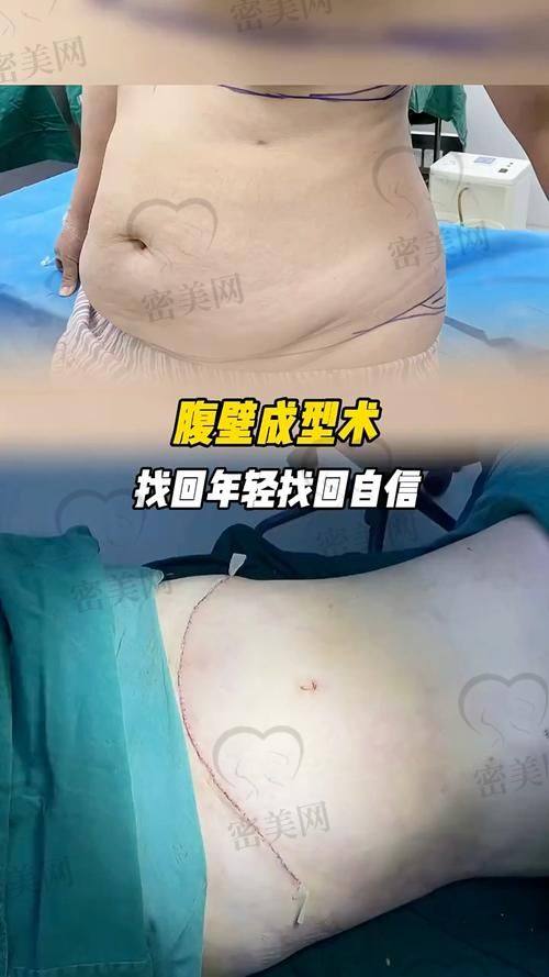 北京米兰柏羽丽都整形医院胡彬：医生的魅力与实力