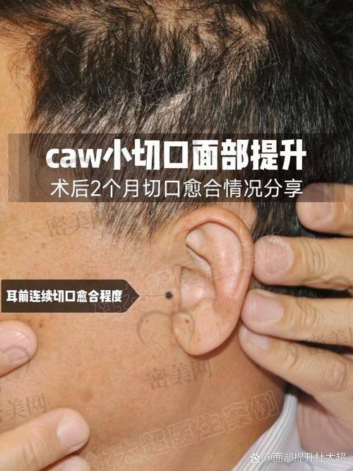 穆宝安和黄寅守谁做的好？先了解一下穆宝安院长