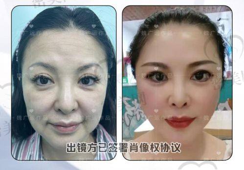 他俩收费标准对比，谁更划算？