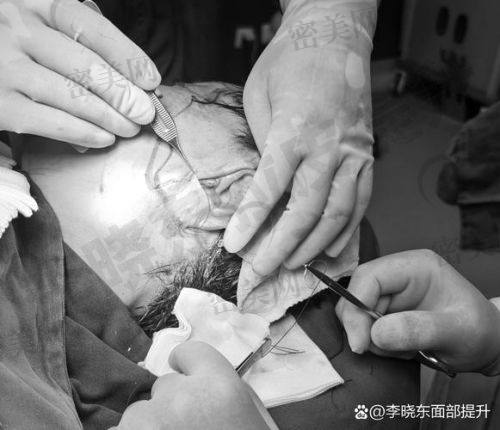 北京穆宝安和李晓东，拉皮界的“华 山论剑”