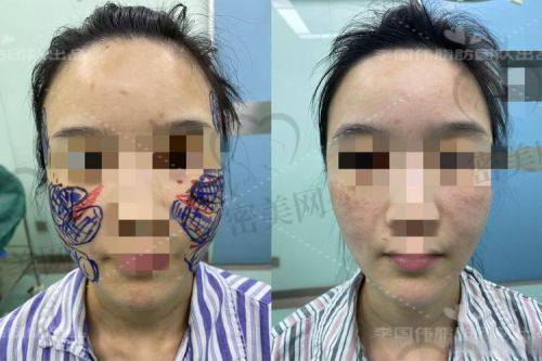 常用的填充方法有哪些