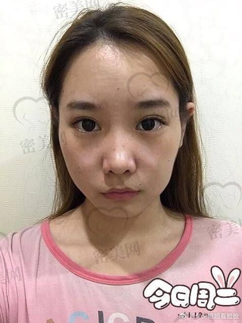 选择正规医院特别重要
