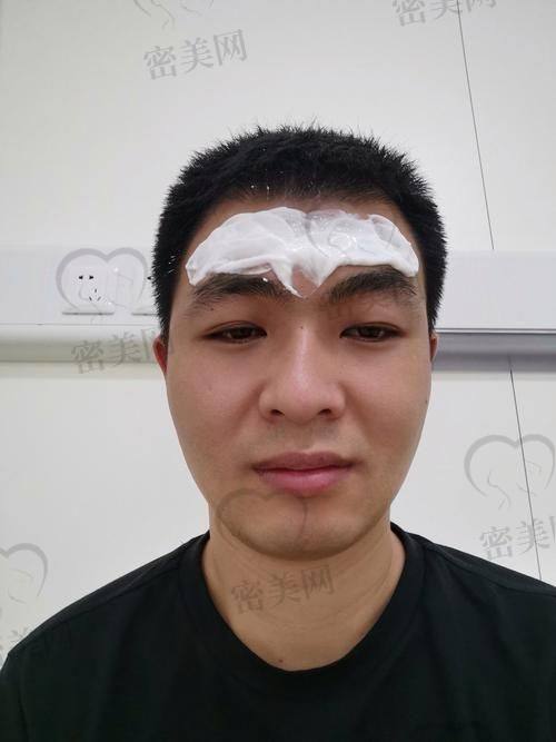 成效能维持多久