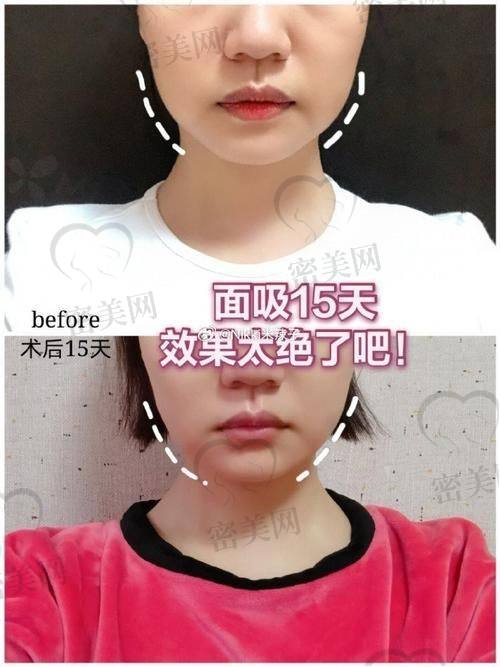 北京美莱田鹏医生是何方神圣？