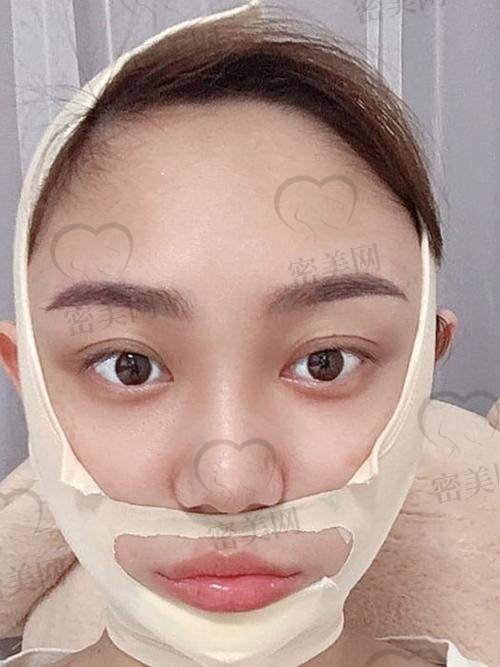 北京美莱田鹏专精能力杠杠滴