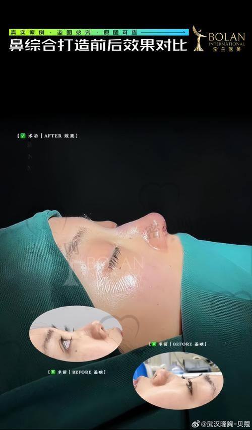 术后修复，惊喜不断