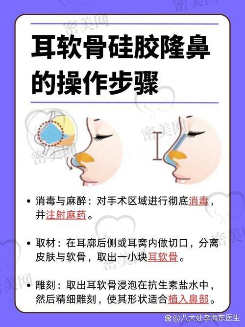 注射隆鼻进行时，医生技术超厉害