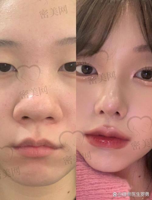 北京华韩整形医院：黄旭培美鼻项目的坚强后盾
