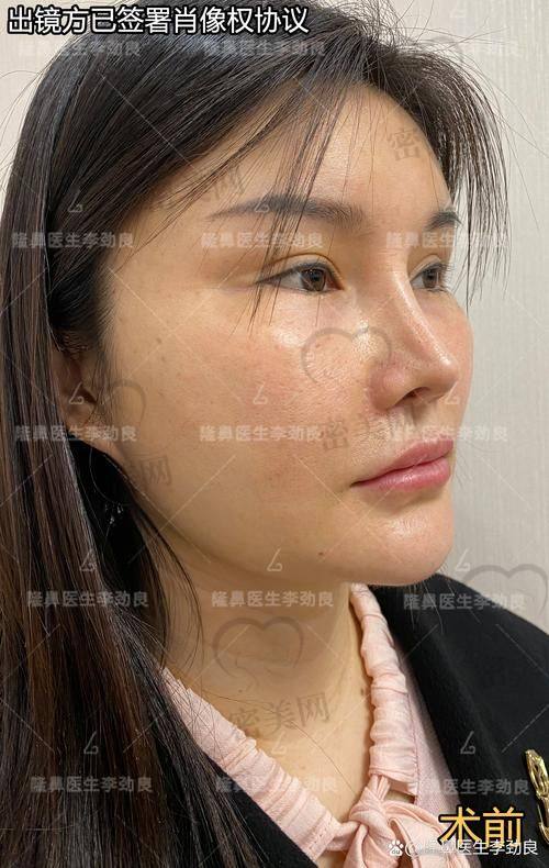 非常爱美携手北京华韩，为你的美鼻之旅助力！