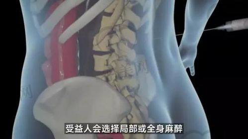 谢立宁医生：隆胸界的“魔法大师”