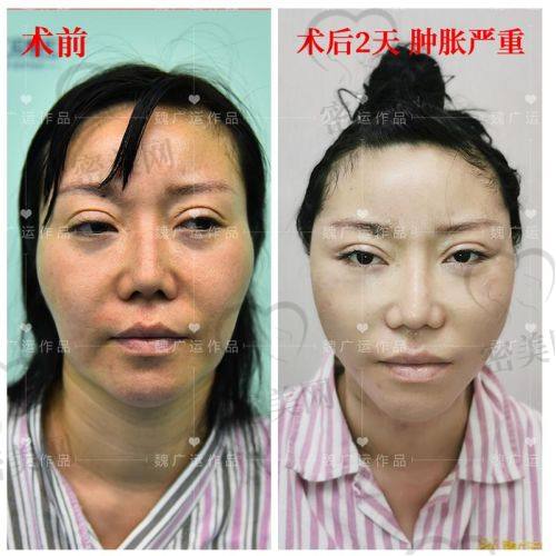 穆宝安真实实例大曝光