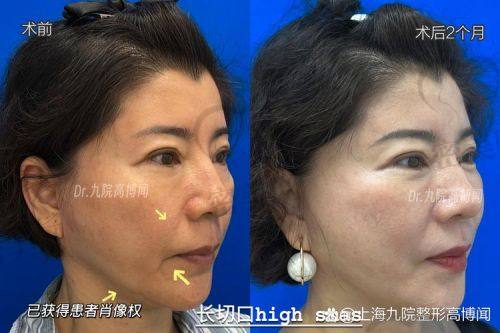加减美穆宝安口碑大调查