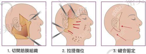 北京米兰柏羽丽都整形医院胡彬：口碑爆棚的秘密武器