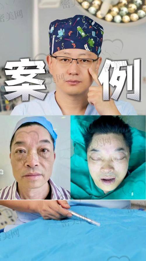 北京米兰柏羽丽都整形医院胡彬：医生的魅力无法挡
