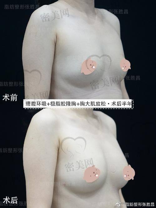 北京米兰柏羽丽都整形医院高海燕：实力医生的魅力！