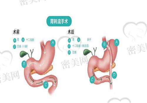 曹美霞医生口碑怎么样？