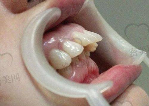上海美维云口腔门诊部口碑怎么样？