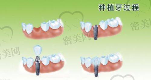 医生专精、设备精良：好牙不是靠便宜打折拼出来的