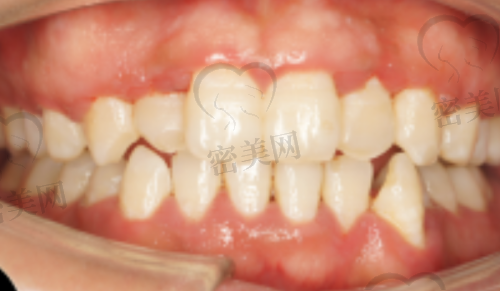 上海朱荷兰口腔诊所是正规的吗？