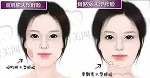 王章霞医生怎么预约挂号？