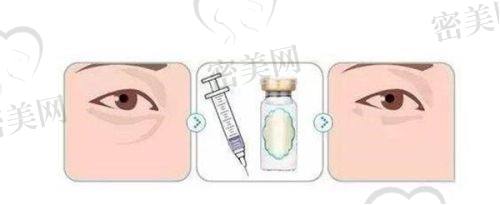 姚义超医生怎么预约挂号？