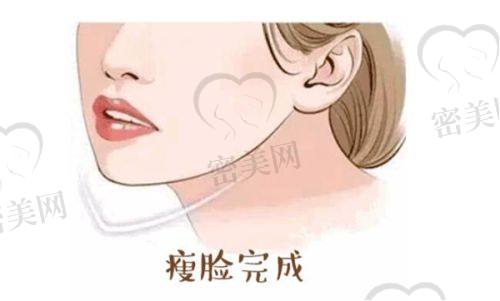 瘦脸成效初显，惊喜连连