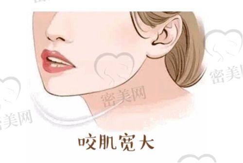 打瘦脸针的奇妙体验
