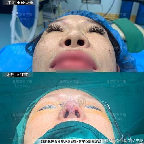 为何网上有人说“做坏了”？专精角度详解流言来源