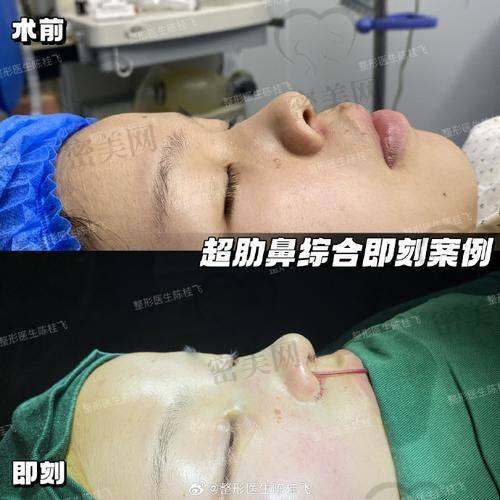 修复手术背后的专精态度，体现医生真正靠谱与否