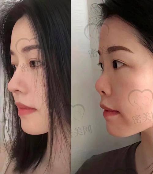 北京米兰柏羽丽都整形医院胡彬：医生超神啦！